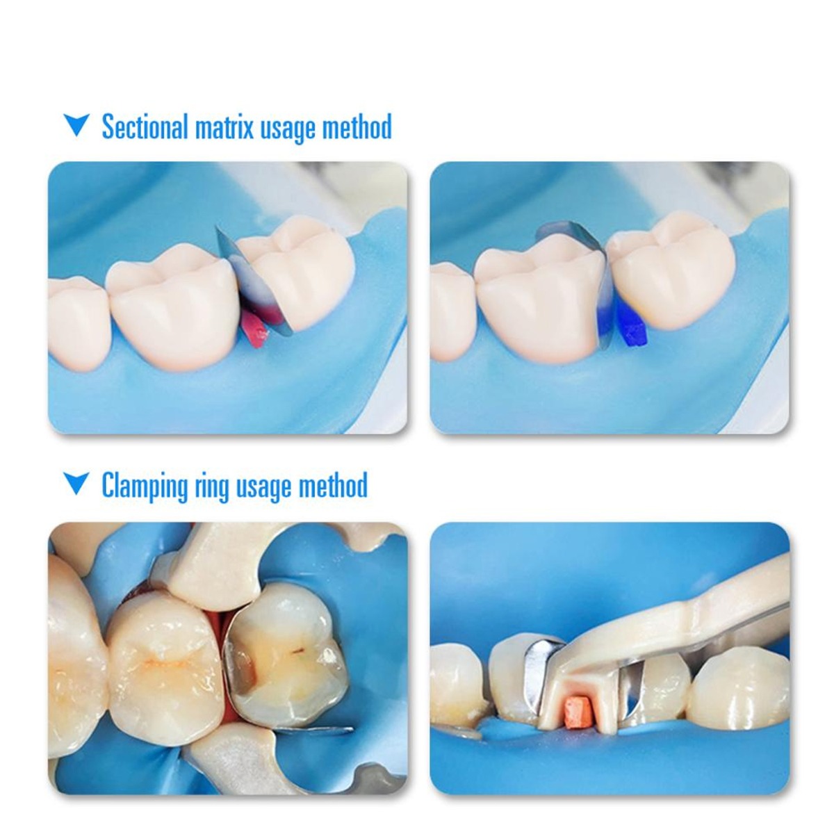 ET Dental Sectional Contoured Matrices Refill