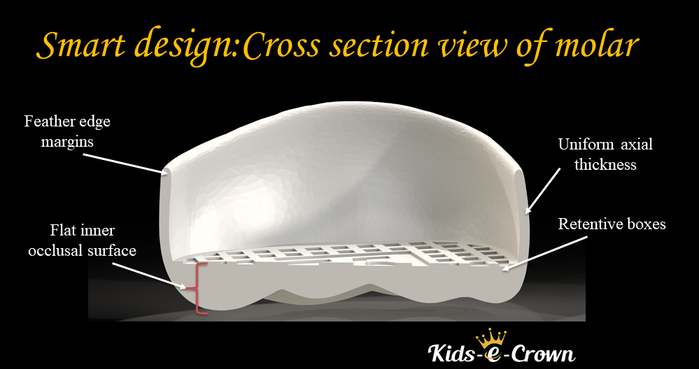 Kids-e-Crown Primary First Molar Kits