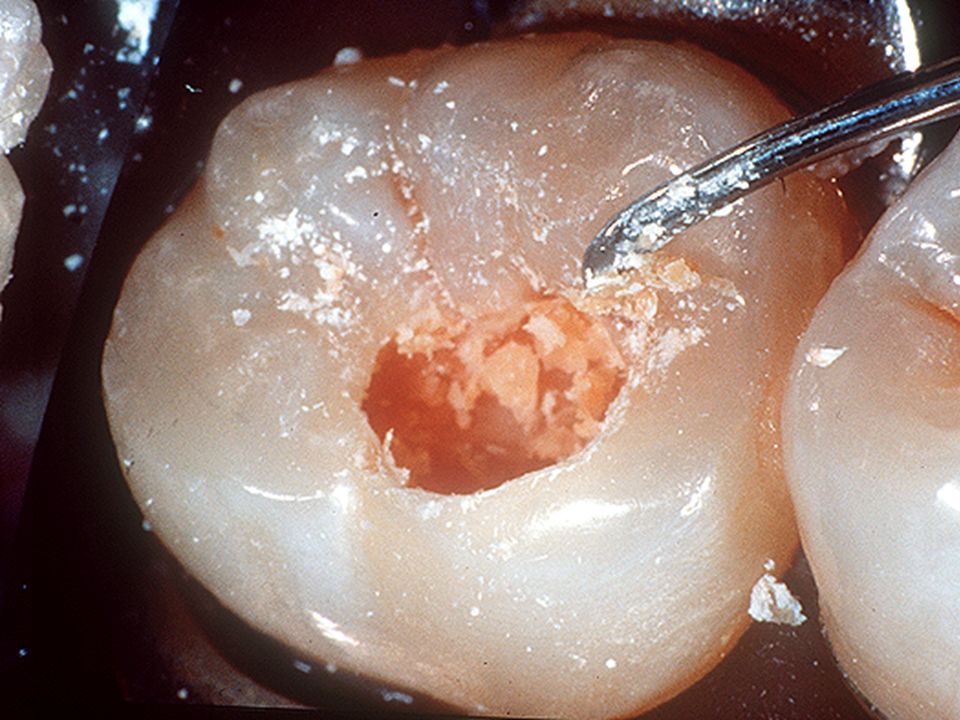 GDC Darby-Perry Spoon Excavator -3 (EXC 210/211)