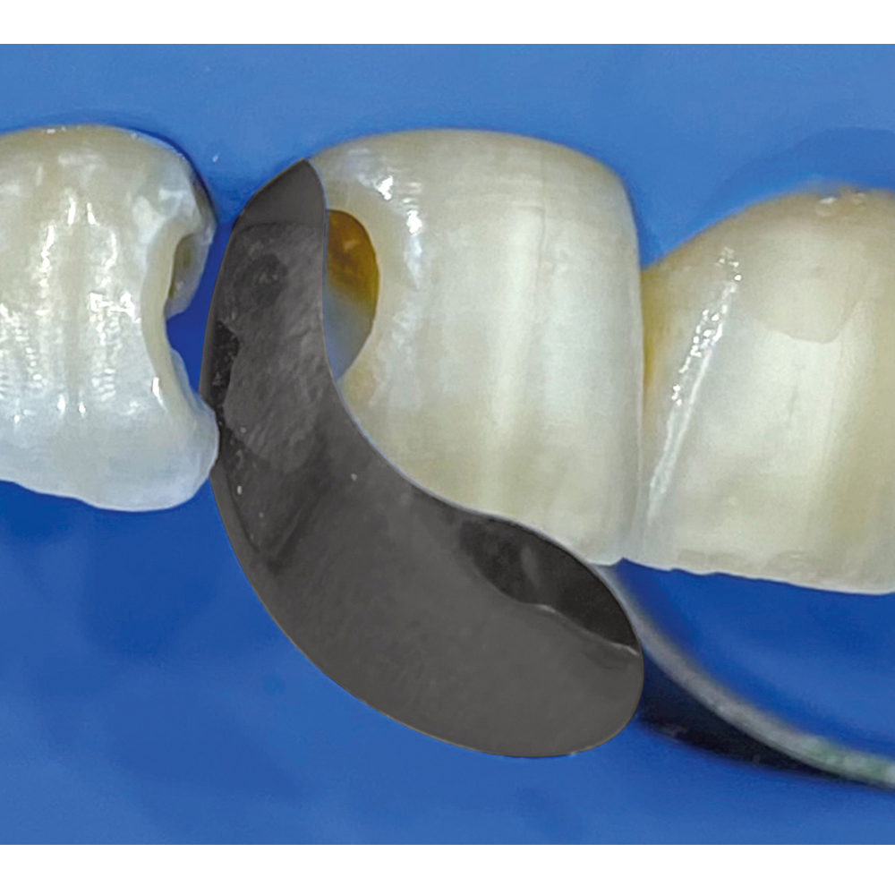 Polydentia Quickmat Sectional Matrices