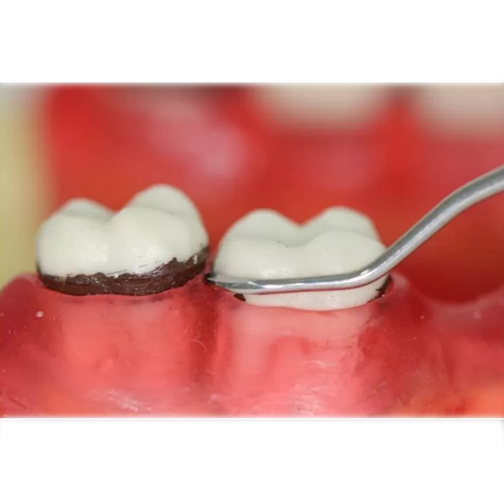 GDC Sickle Scalers Remington #6 (Srm3/4)