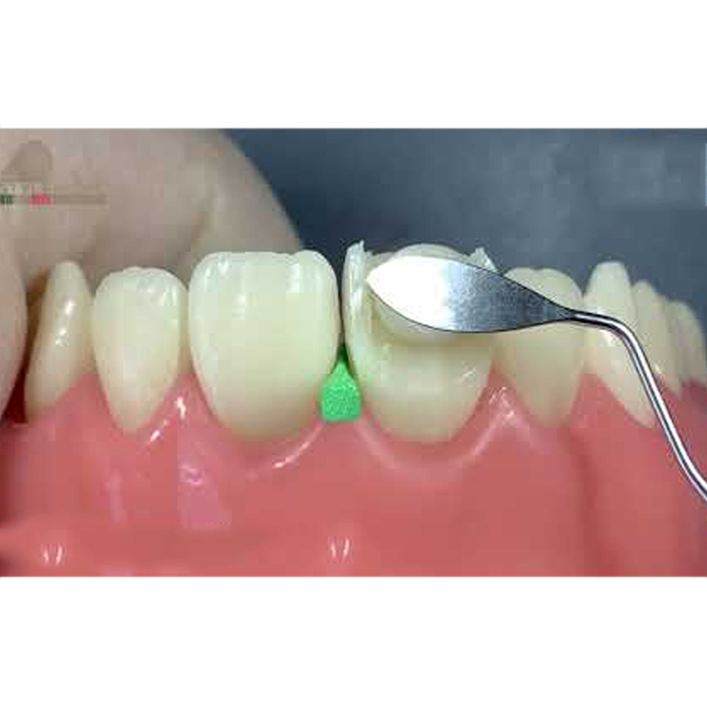 GDC Restore Instrument - Solo Anterior