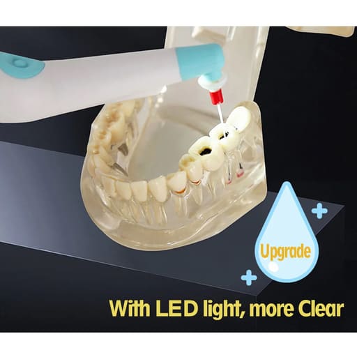 SuperEndo Sonic Flush Endo Irrigator LED (120 Tips Free)