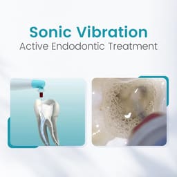 SuperEndo Sonic Flush Endo Irrigator (120 Tips Free) - 8
