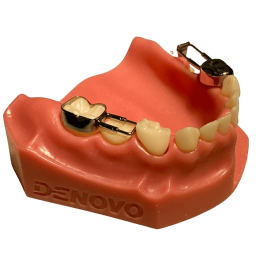 Kids-e-Dental Space Maintainer Band Refills