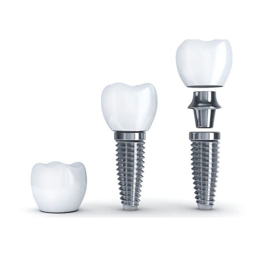 Nextin Spera Conventional Dental Implant With Cover Screw 3.5mm