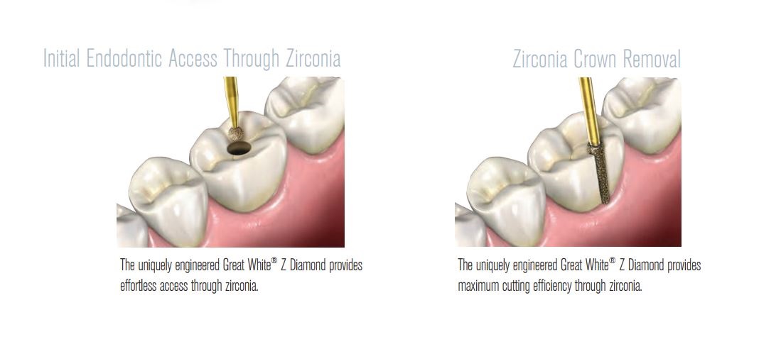 Great WhiteZ Introductory Kit