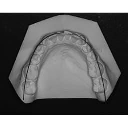 OrthoMetric SS Straight Length Wire (10/Pk) - 10