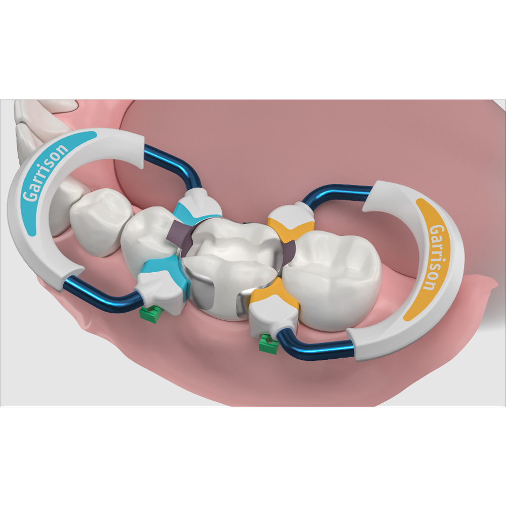 Garrison Dental Strata-G Sectional Matrix Bands
