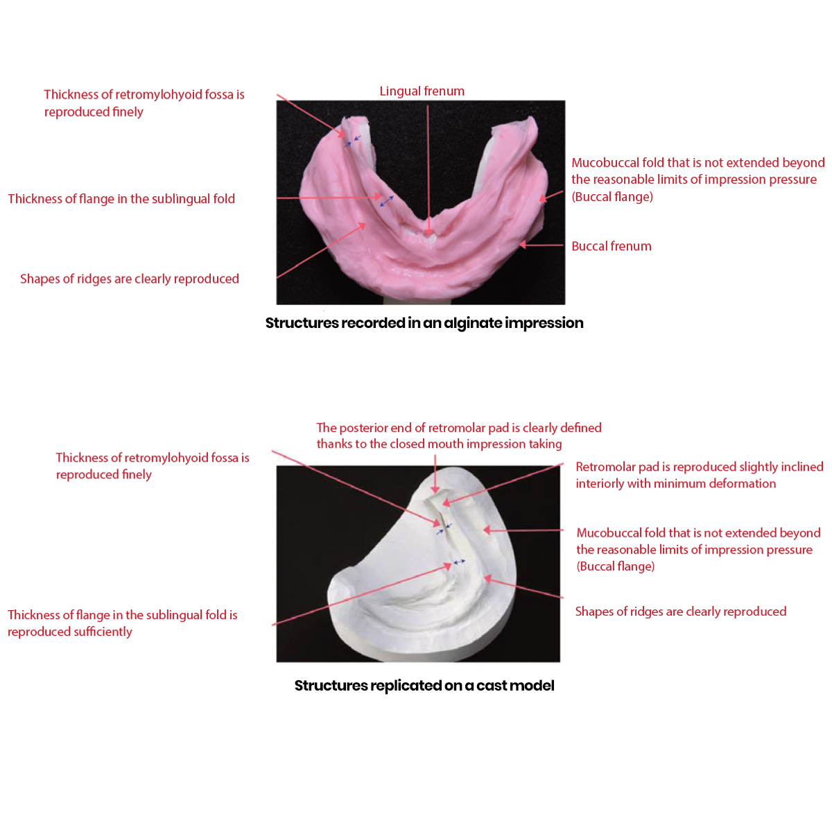 J Morita Frame Cut Back Tray - Medium/Large