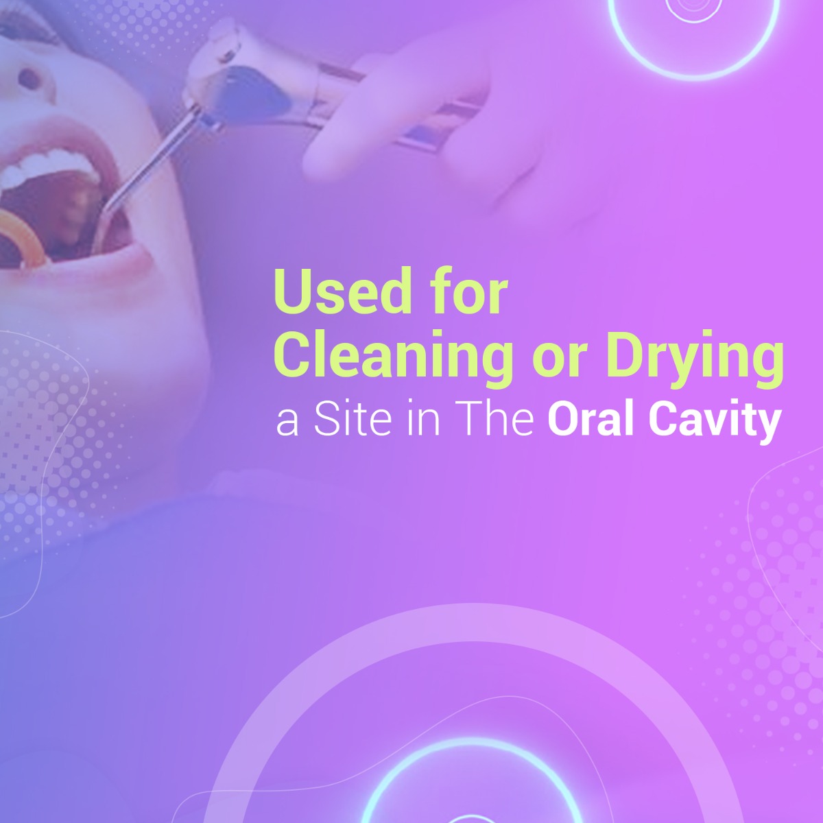 Waldent 3-Way Syringe - Standard