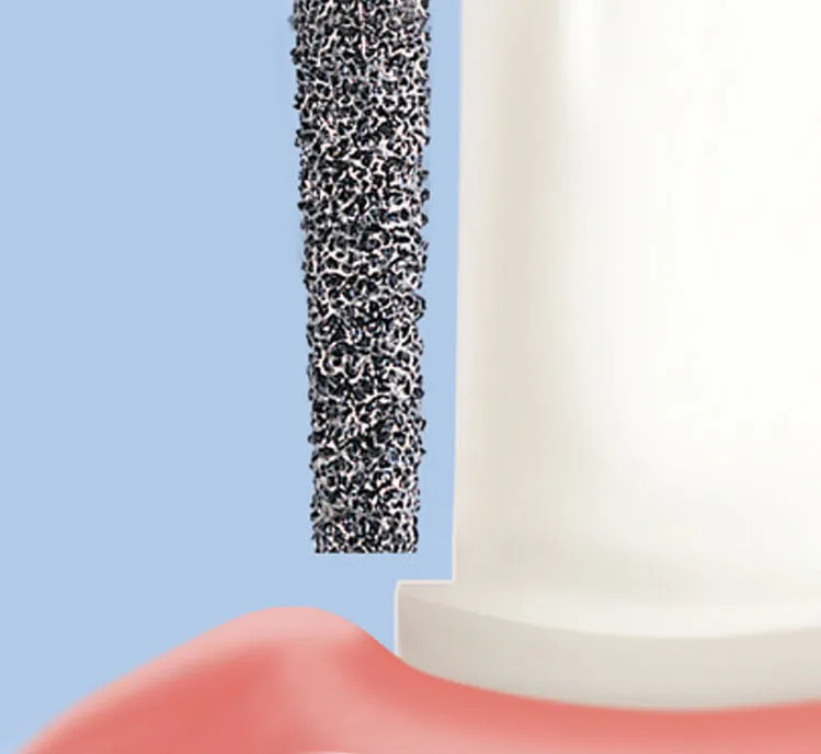 Frank Dental Flat End Taper Diamond Bur TF Series (Coarse)