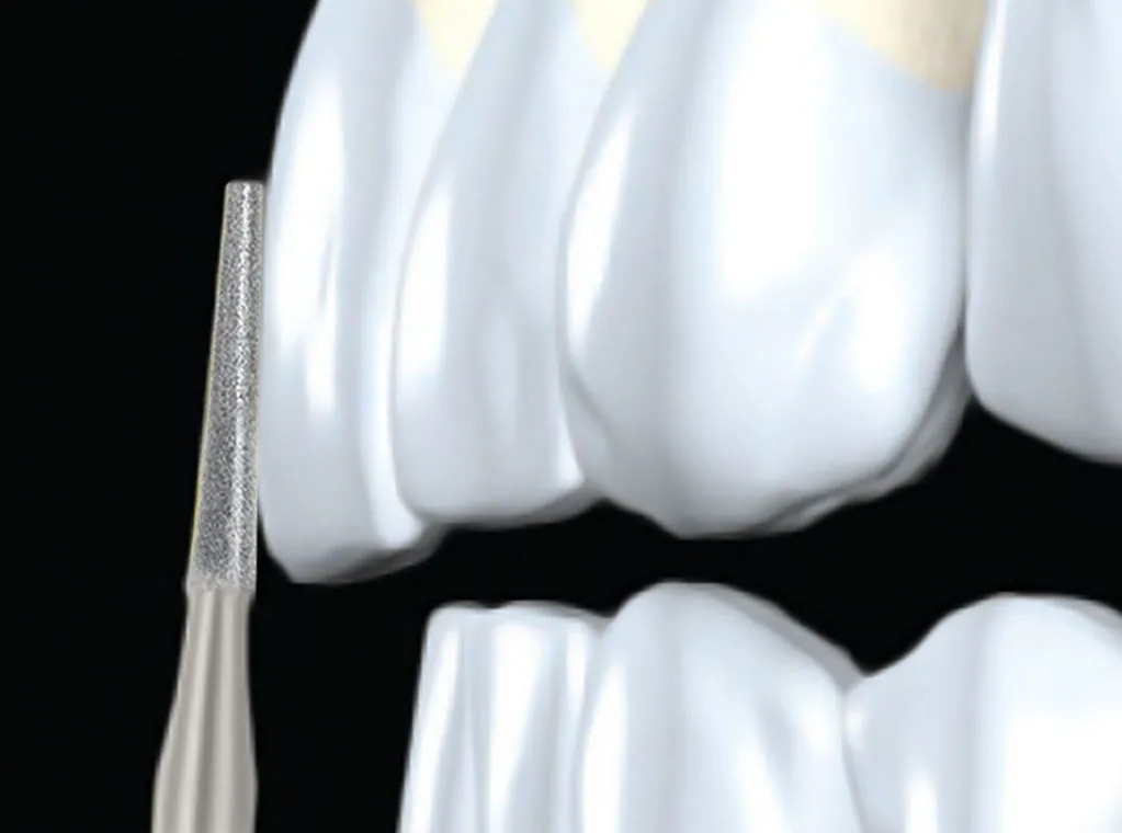 Frank Dental Flat End Taper Diamond Bur TF Series (Coarse)