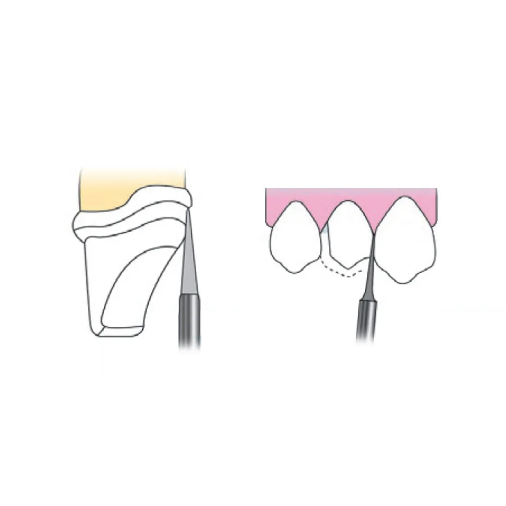 Frank Dental Tapered Cone FG Diamond Burs TC Series ( Super Coarse)