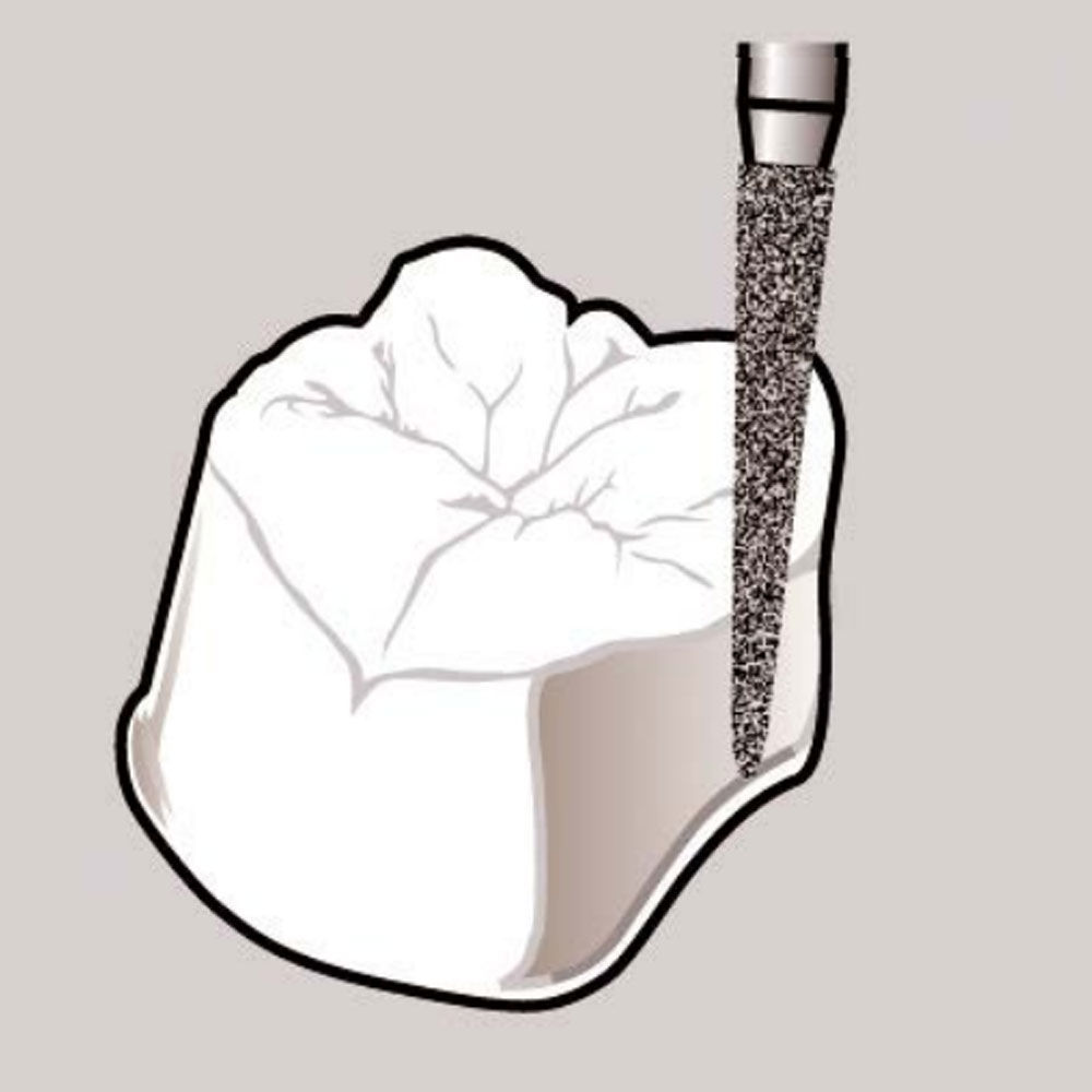 Frank Dental Tapered Cone FG Diamond Burs TC Series (Regular)