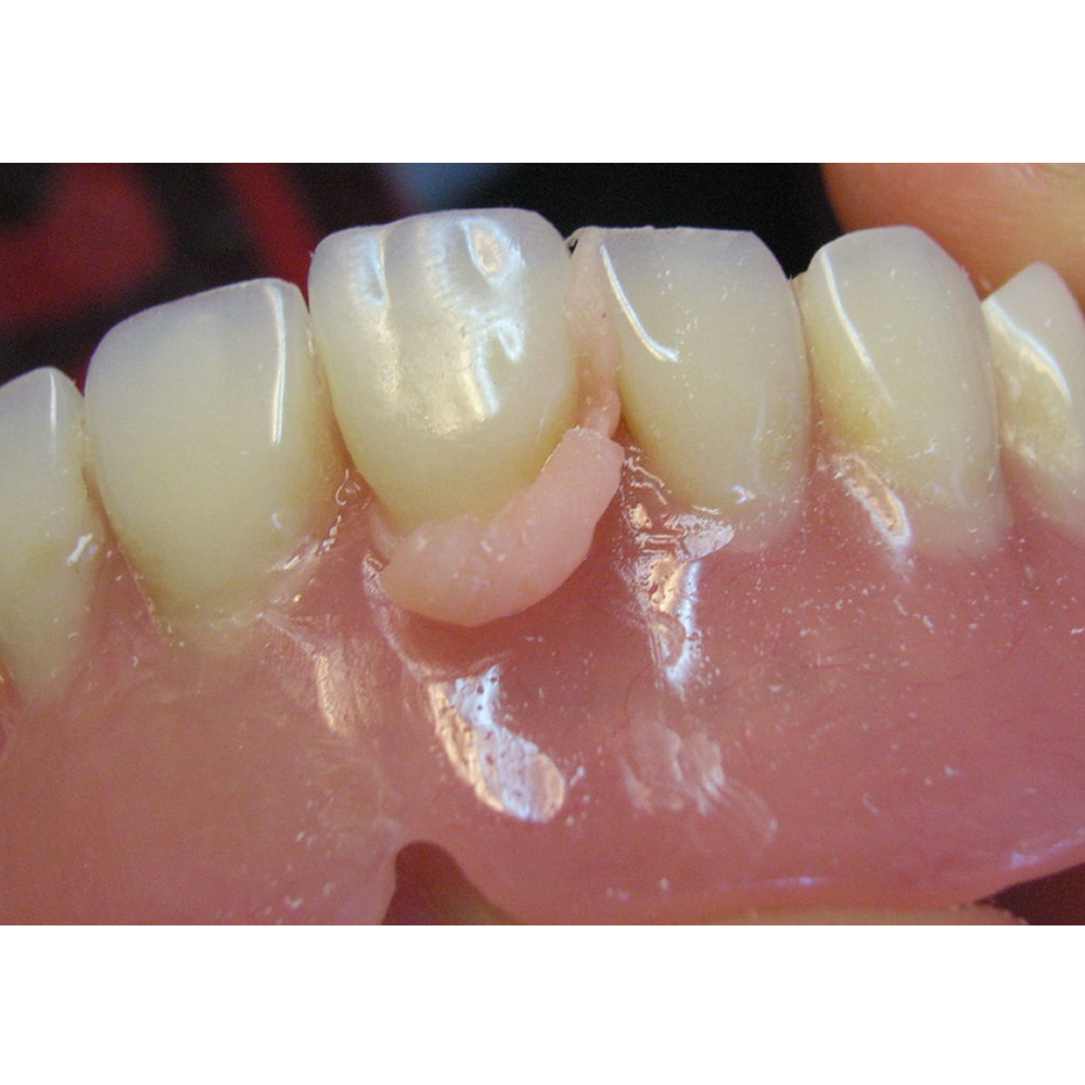 API Acrylic Teeth Sets - NewDent A1 (Pack of 4 Sets)