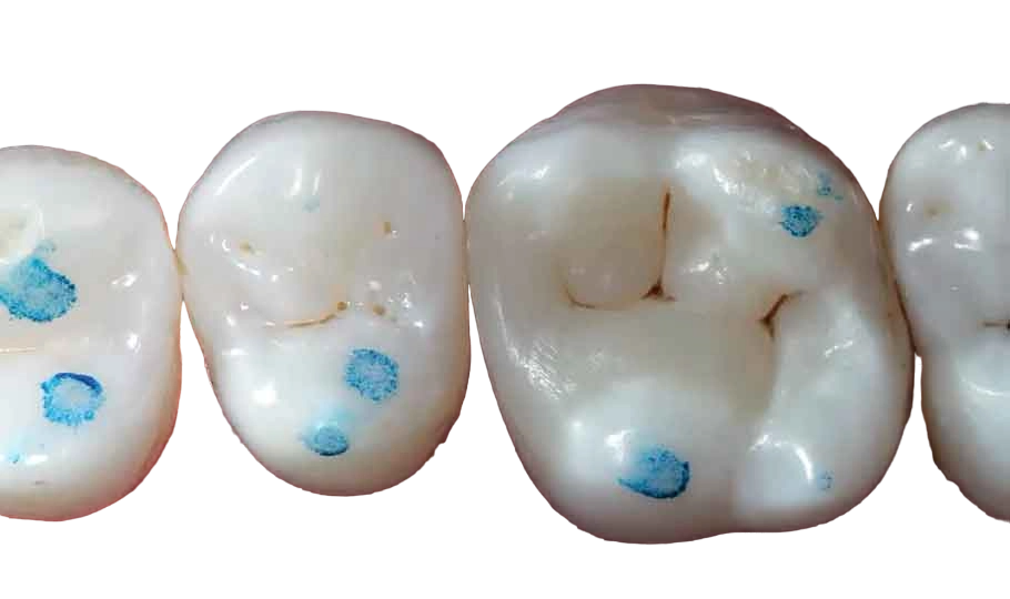 SuperEndo Dental Articulating Paper