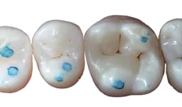 SuperEndo Dental Articulating Paper - 12