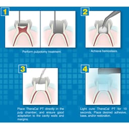 Bisco TheraCal PT DC Resin Modified Calcium Silicate Material - 5