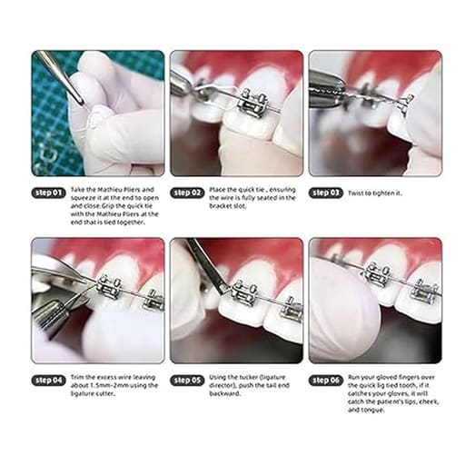 OSL SS Preformed Ligature Ties - Short (Pack Of 100)