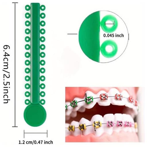 OSL Orthodontic Ligature Ties (Pack Of 1000)