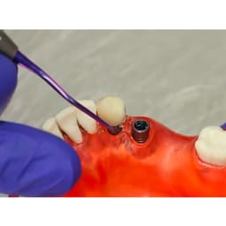 GDC Titanium Implant Curettes and Scalers - 5