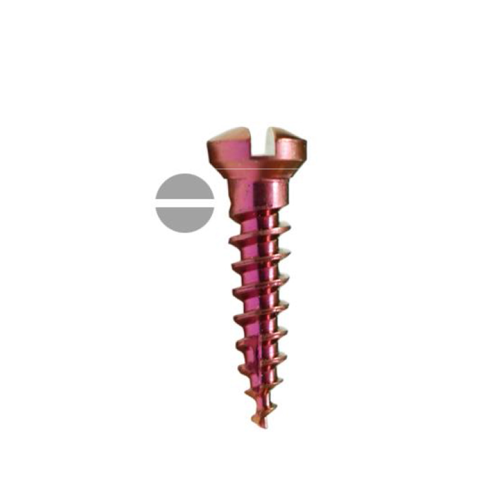 SK Surgicals Titanium Single Slot Screws - 1.5mm x 5mm (1505T)