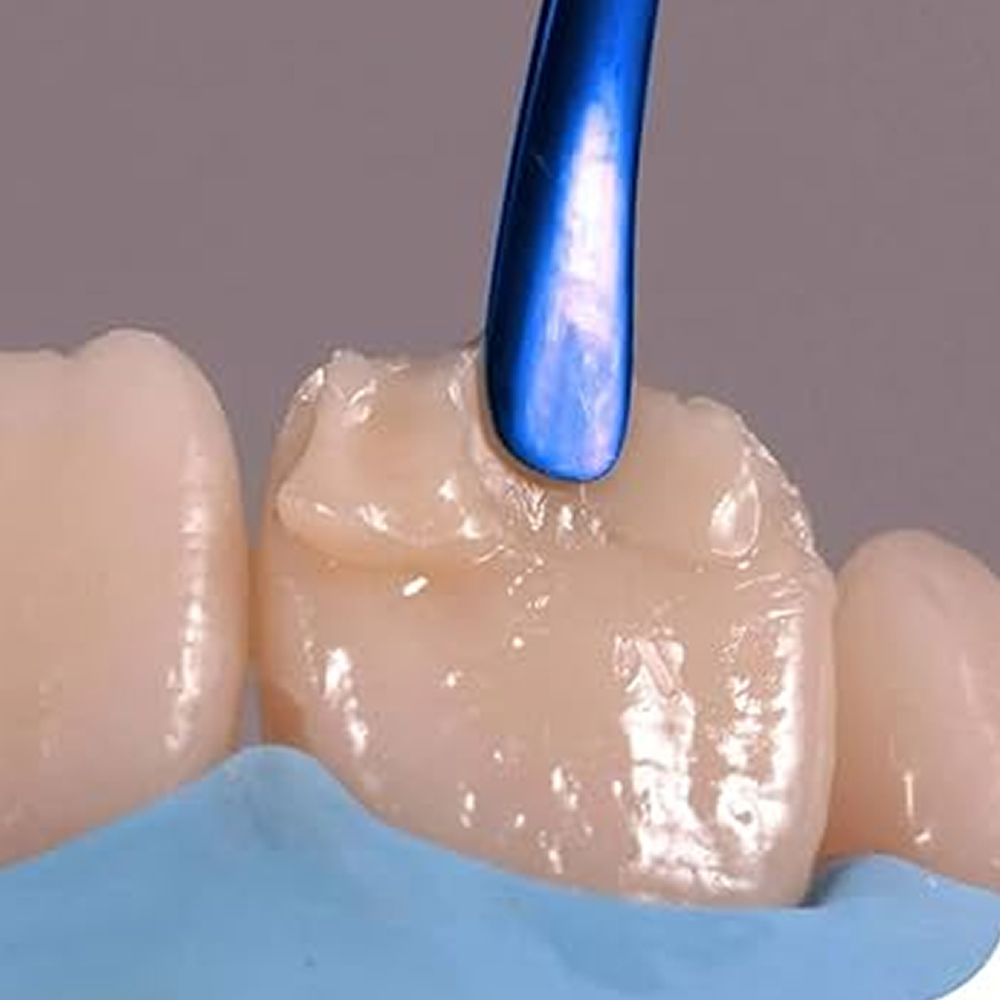 GDC Titanium Coated Composite Anterior Placing (Tncipcm)