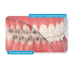 U ortho Niti Tooth Color Wire-Rectangular (Pack of 1) - 15