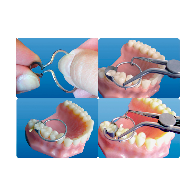 Tor Vm Saddle Contoured Metal Matrices