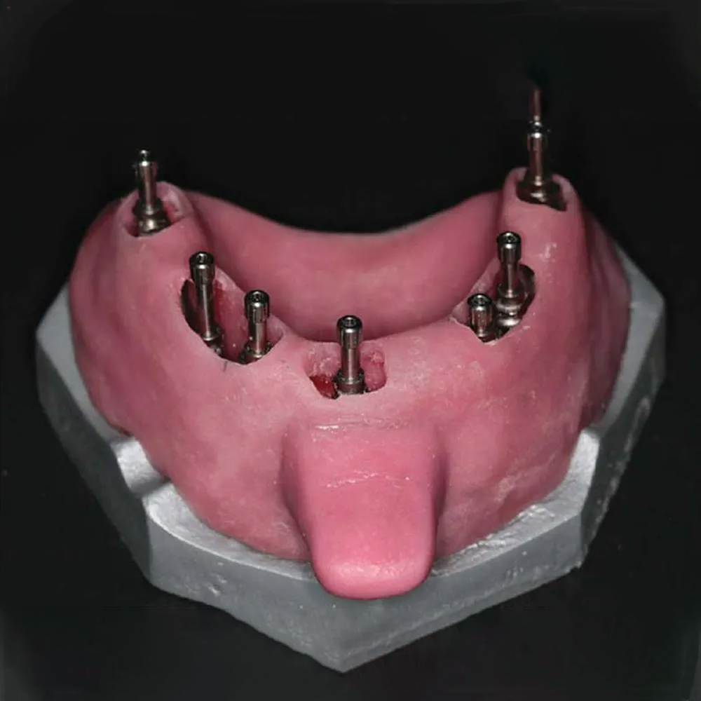 Adin RS Open Tray Slim Transfer