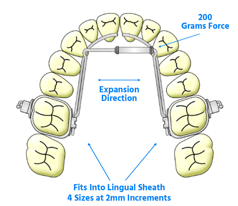 Ortho Organizers Transforce Transverse Appliance