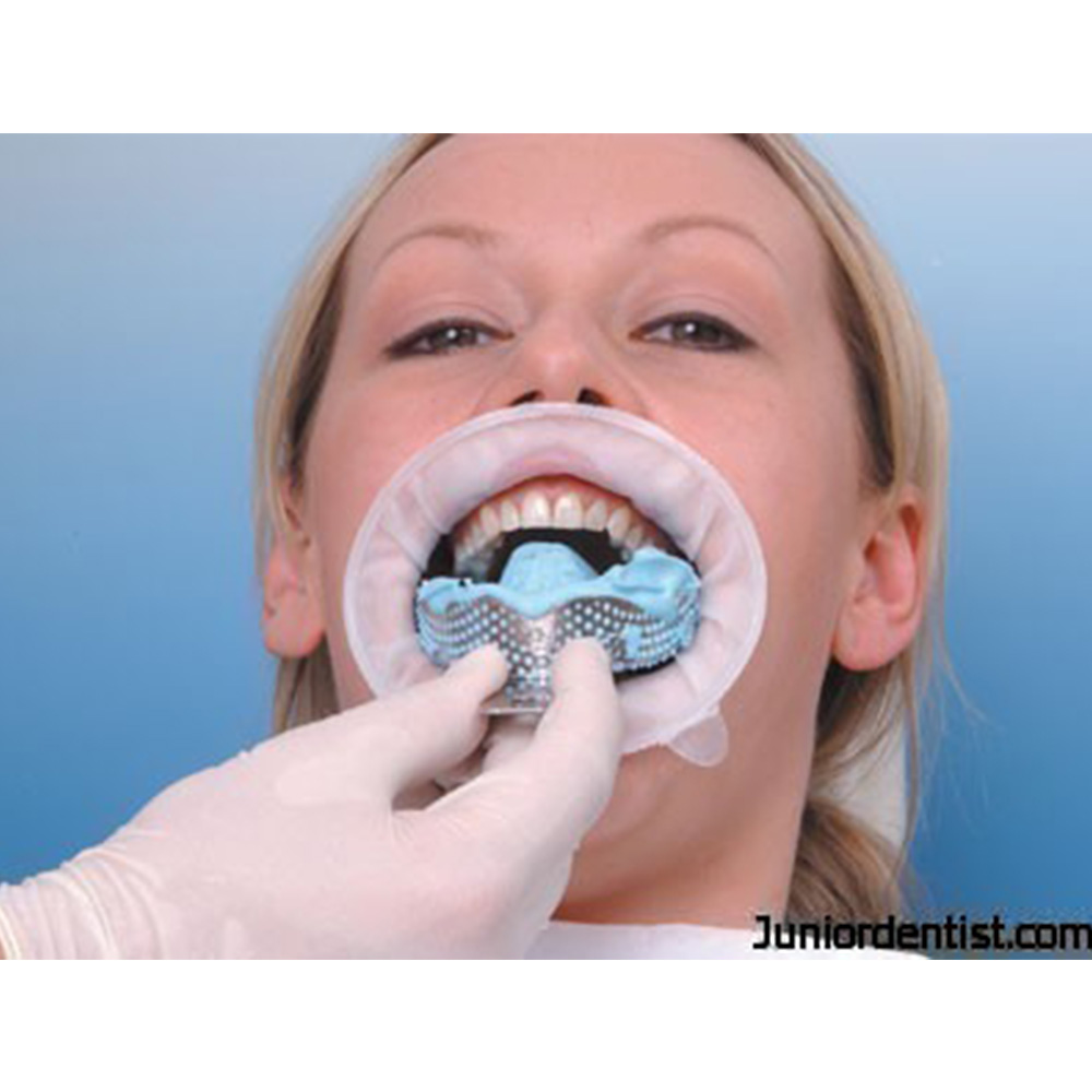 GDC Impression Tray Dentulous Perforated Kit Set of 8 (ITRLDPP8)