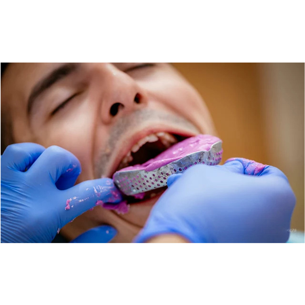 GDC Impression Tray Dentulous Perforated Kit Set of 8 (ITRLDPP8)