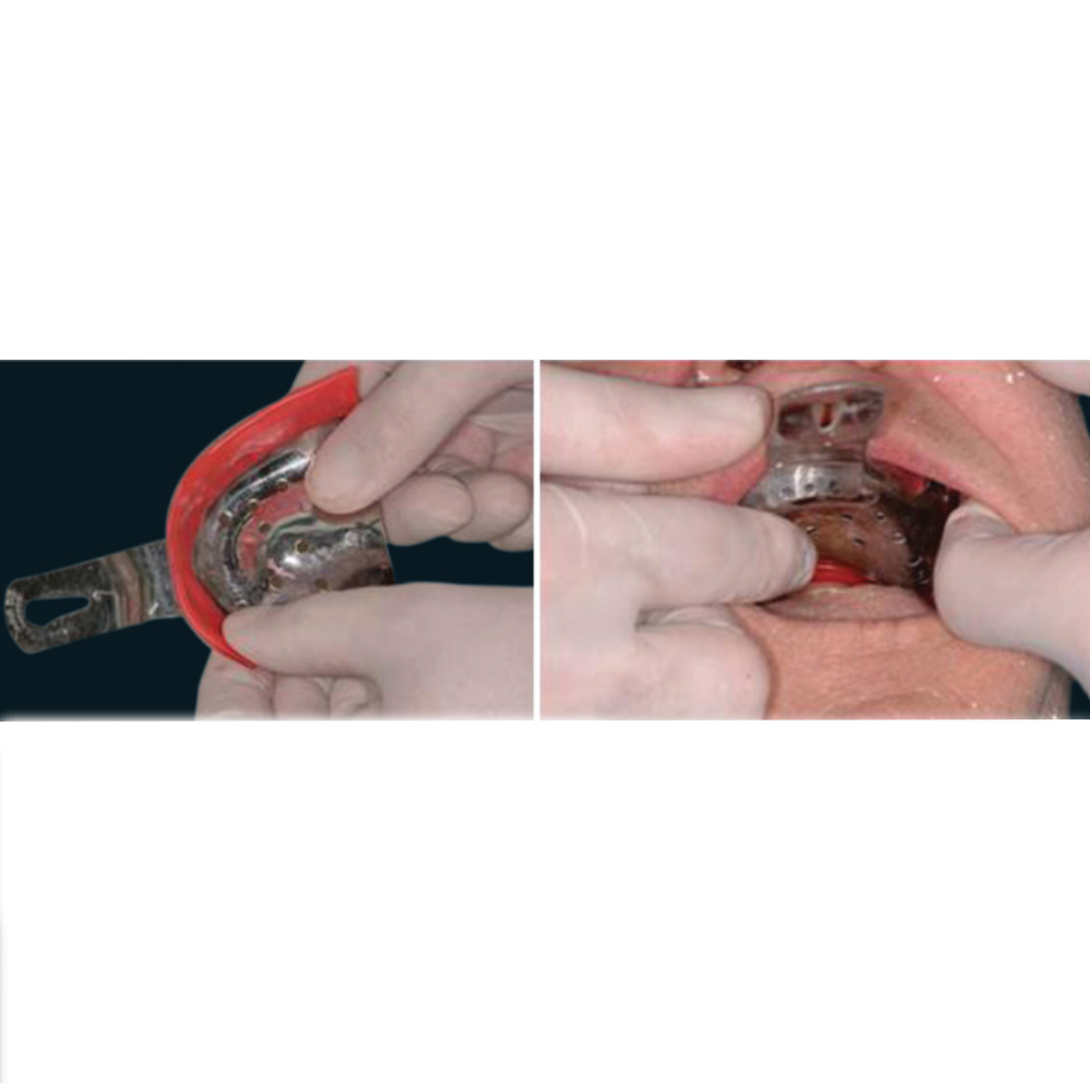 GDC Impression Trays Edentulous Perforated S/8 Instruments Kit (ITRLEDPP8)