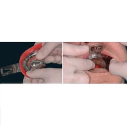 GDC Impression Trays Edentulous Perforated S/8 Instruments Kit (ITRLEDPP8) - 12