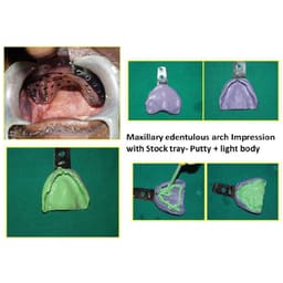 GDC Impression Trays Edentulous Perforated S/8 Instruments Kit (ITRLEDPP8) - 11