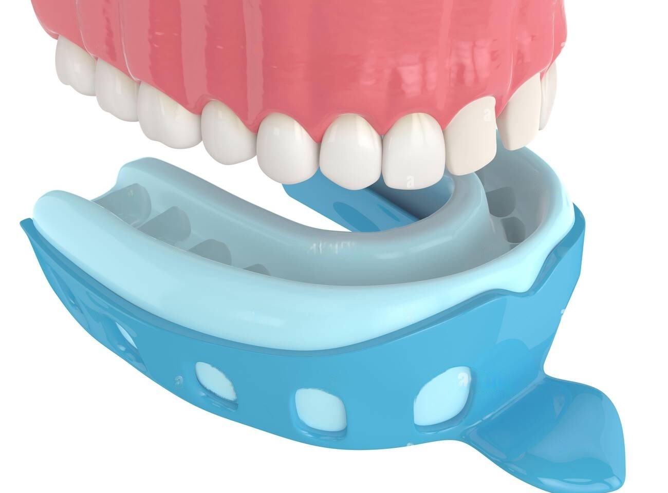 LD Venus Dental Eco Autoclavable Impression Tray