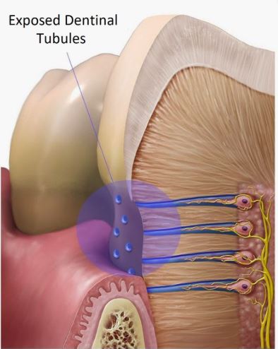 Maarc D-Sens G+ (3019/002)