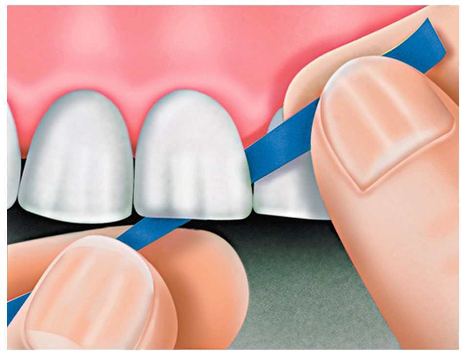 Tor Vm Polishing Strips Universal Kit (75pcs) No. 1.055