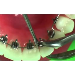 OSL Ligature Tucker - 3