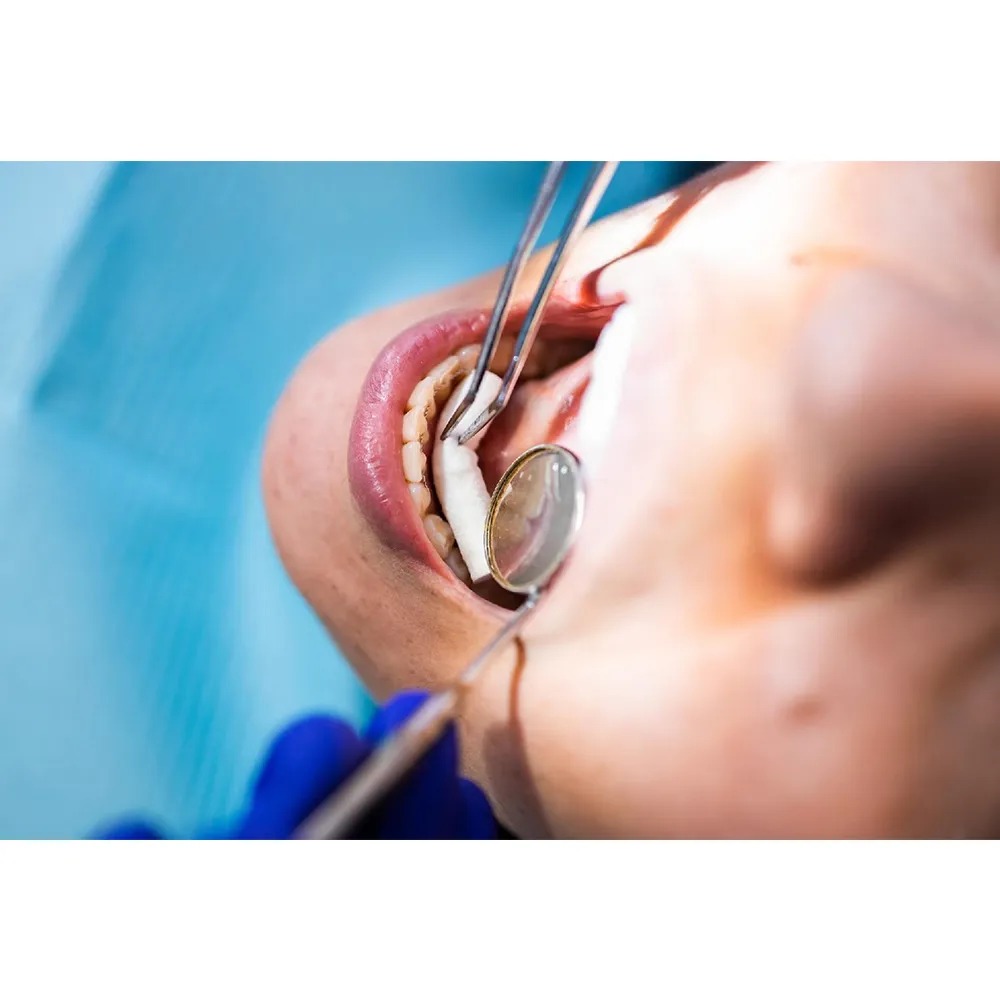 Waldent Marium Tweezer (23/112)