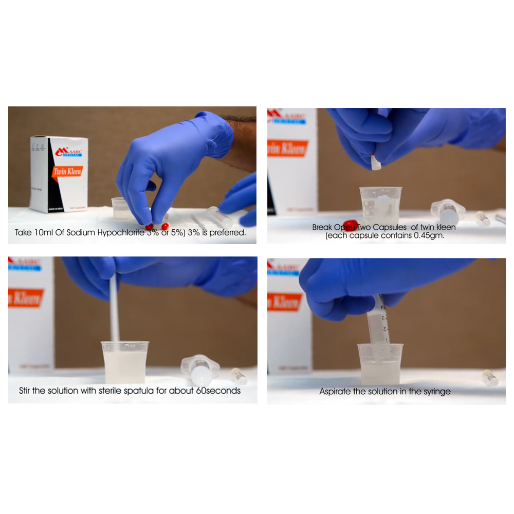 Maarc Twin Kleen Capsules (Root Canal Irrigant)