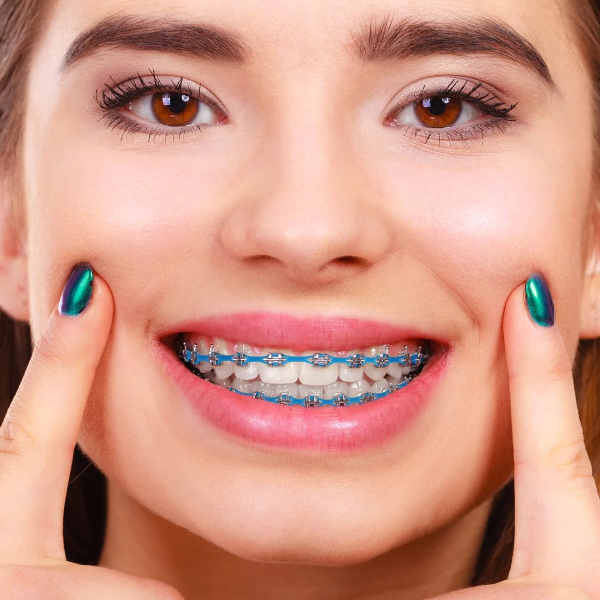 U Ortho E-Chain (15 ft) - Continuous White