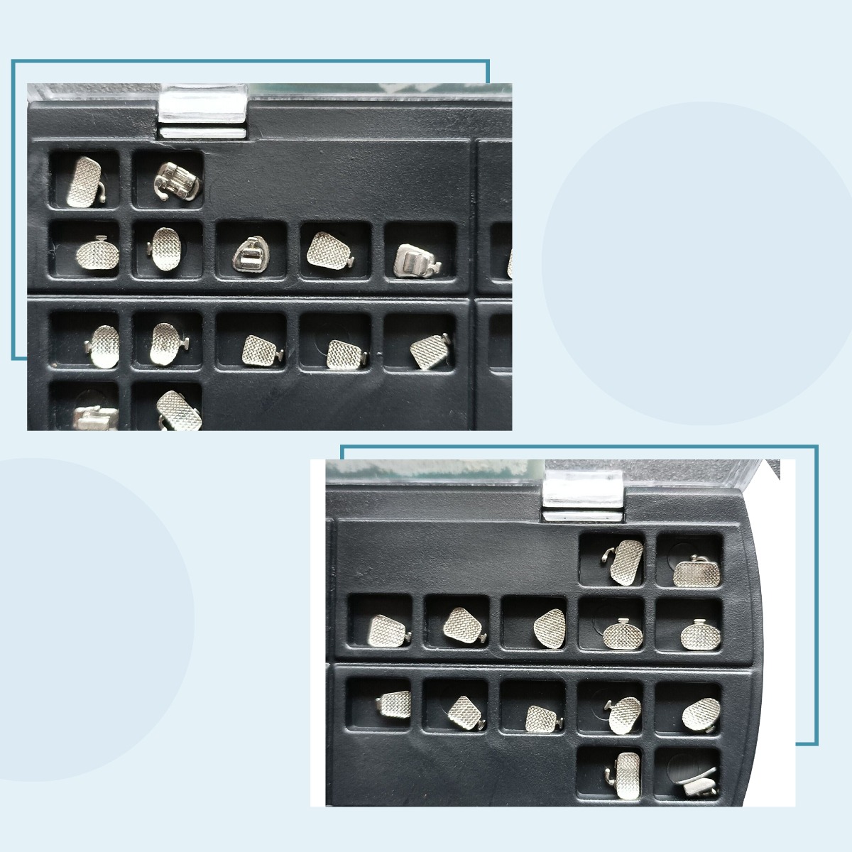 U Ortho Lingual Brackets 018