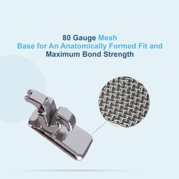 U Ortho Lingual Brackets 018 - 9