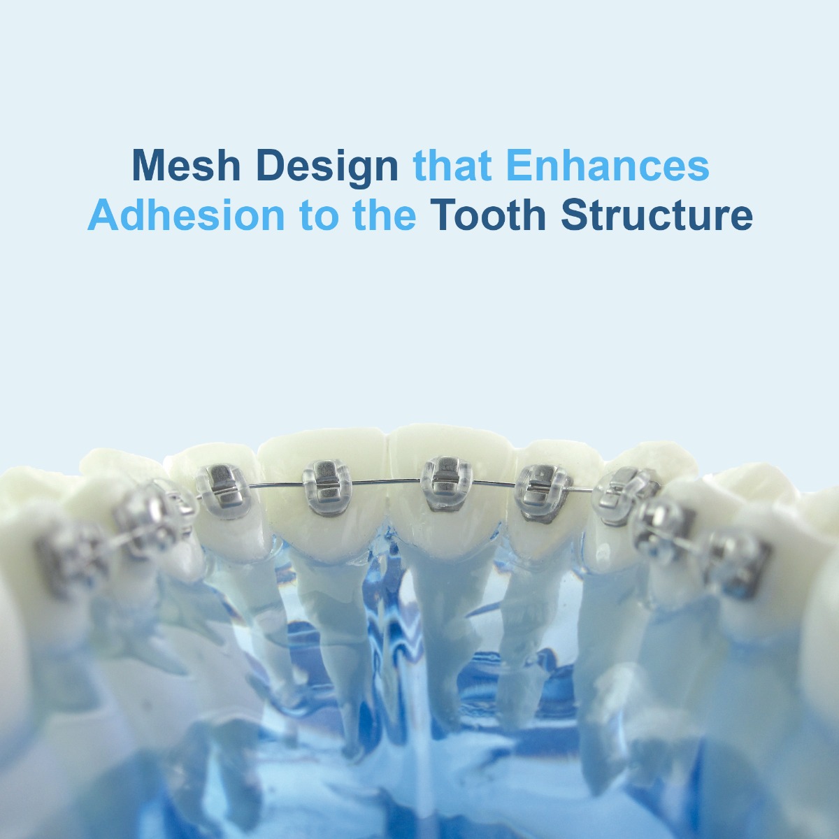 U Ortho Lingual Brackets 018