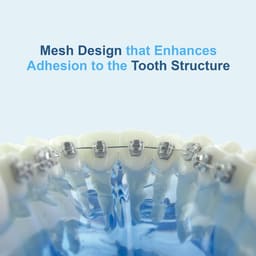 U Ortho Lingual Brackets 018 - 10