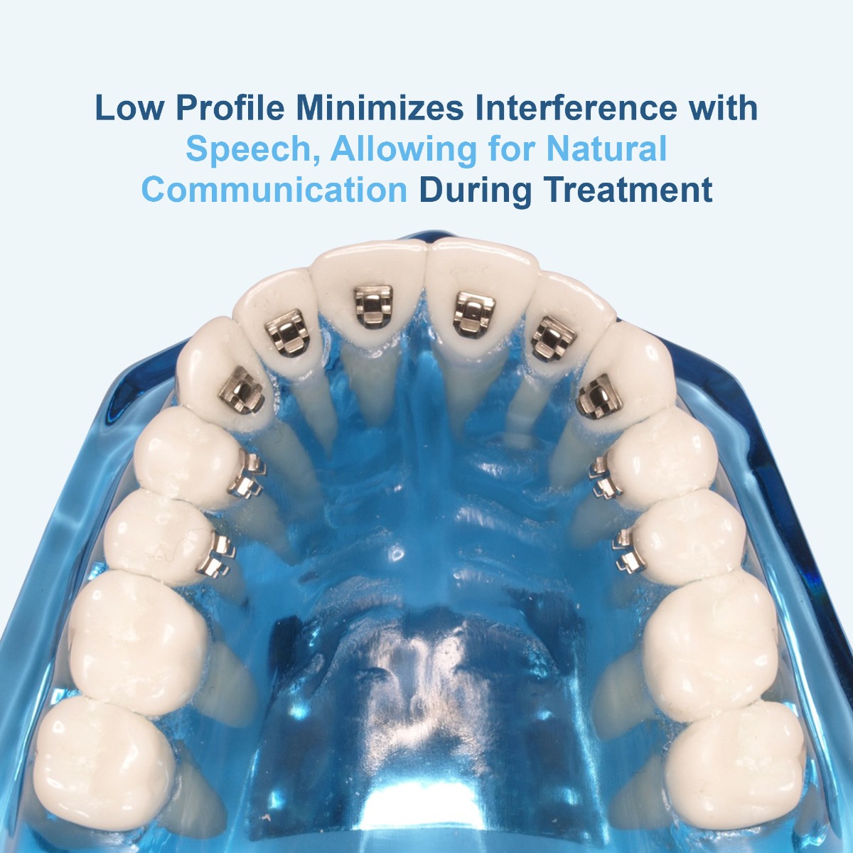 U Ortho Lingual Brackets 018