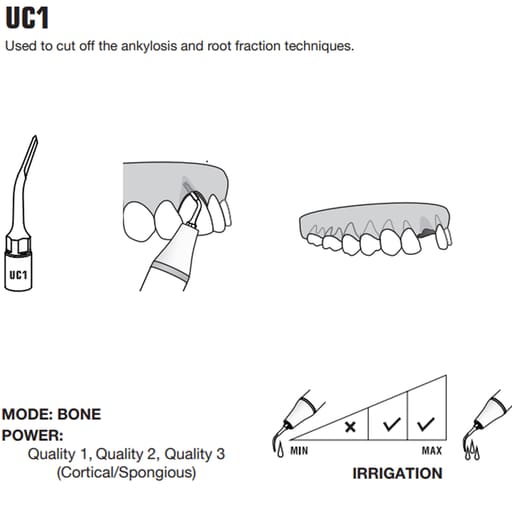 Woodpecker Piezo Bone Surgery Tips